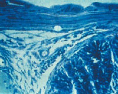 Как вывести грибок в квартире. Как не допустить появления грибка 04 Как вывести грибок в квартире. Как не допустить появления грибка 04