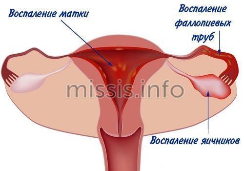 Противомикробные препараты для системного применения. Метронидазол / Metronidazole 02 Противомикробные препараты для системного применения. Метронидазол / Metronidazole 02