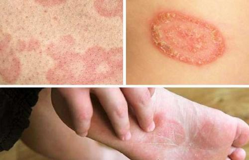 Лучшее средство от плесени на бетоне. Антисептик для обработки бетона от плесени и грибка (топ лучших средств)