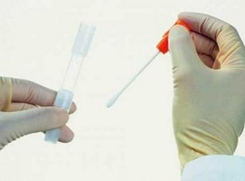 Мазок из зева и носа. Что это за анализ, когда и зачем назначают 01
