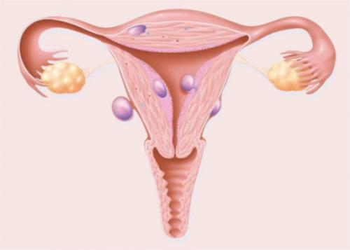 Можно ли спринцеваться медным купоросом. Можно ли делать спринцевание 04 Можно ли спринцеваться медным купоросом. Можно ли делать спринцевание 04